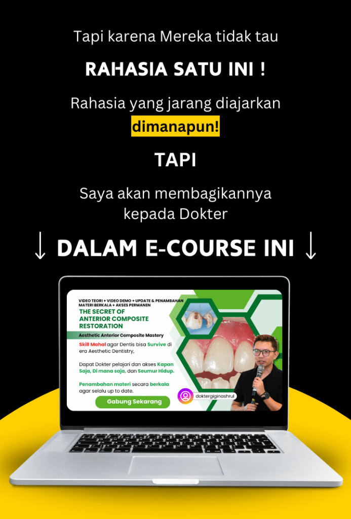 Rahasia Tambalan estetik anterior komposit, dentist hacks, dokter gigi nashrul