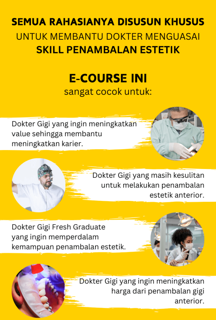 Rahasia Tambalan estetik anterior komposit, dentist hacks, dokter gigi nashrul