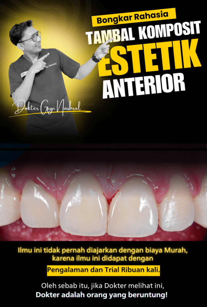 TAMBAL KOMPOSIT ANTERIOR ESTETIK